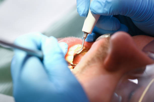 Best Emergency Treatment for Toothache in West Columbia, TX