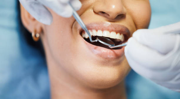 Best Emergency Root Canal Treatment in West Columbia, TX